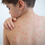 Seis víctimas mortales tras hecho violento entre Popayán y Cajibío