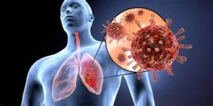 Tips para reducir el riesgo de infecciones respiratorias en casa