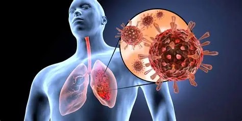 Tips para reducir el riesgo de infecciones respiratorias en casa